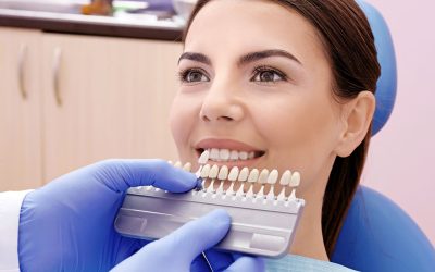 Faccette in ceramica