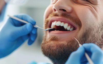 Igiene orale professionale