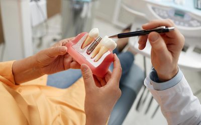 Implantologia dentale